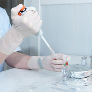 Vloeistofbehandeling