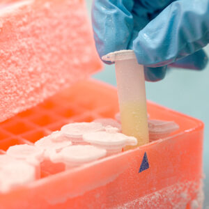 Koeling en cryogenisatie